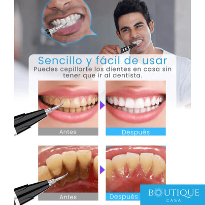 UltraSmile - Sonrisa brillante todos los días