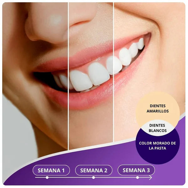 LumiDent - Aclara Tu Sonrisa al Instante