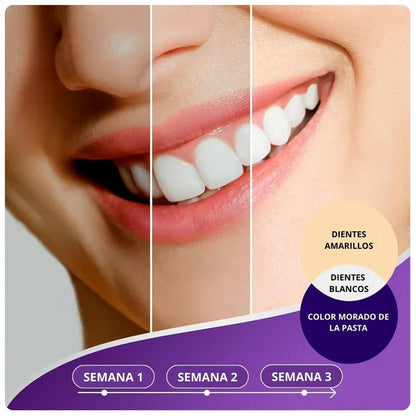 LumiDent - Aclara Tu Sonrisa al Instante