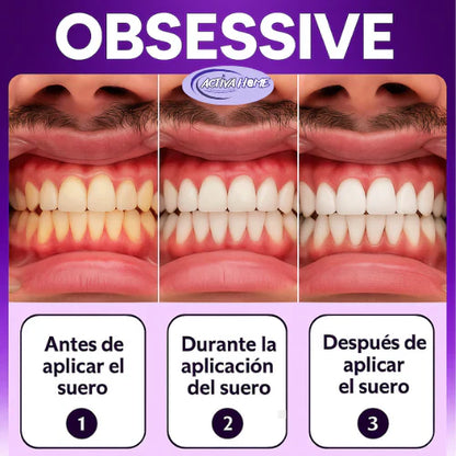 LumiDent - Aclara Tu Sonrisa al Instante